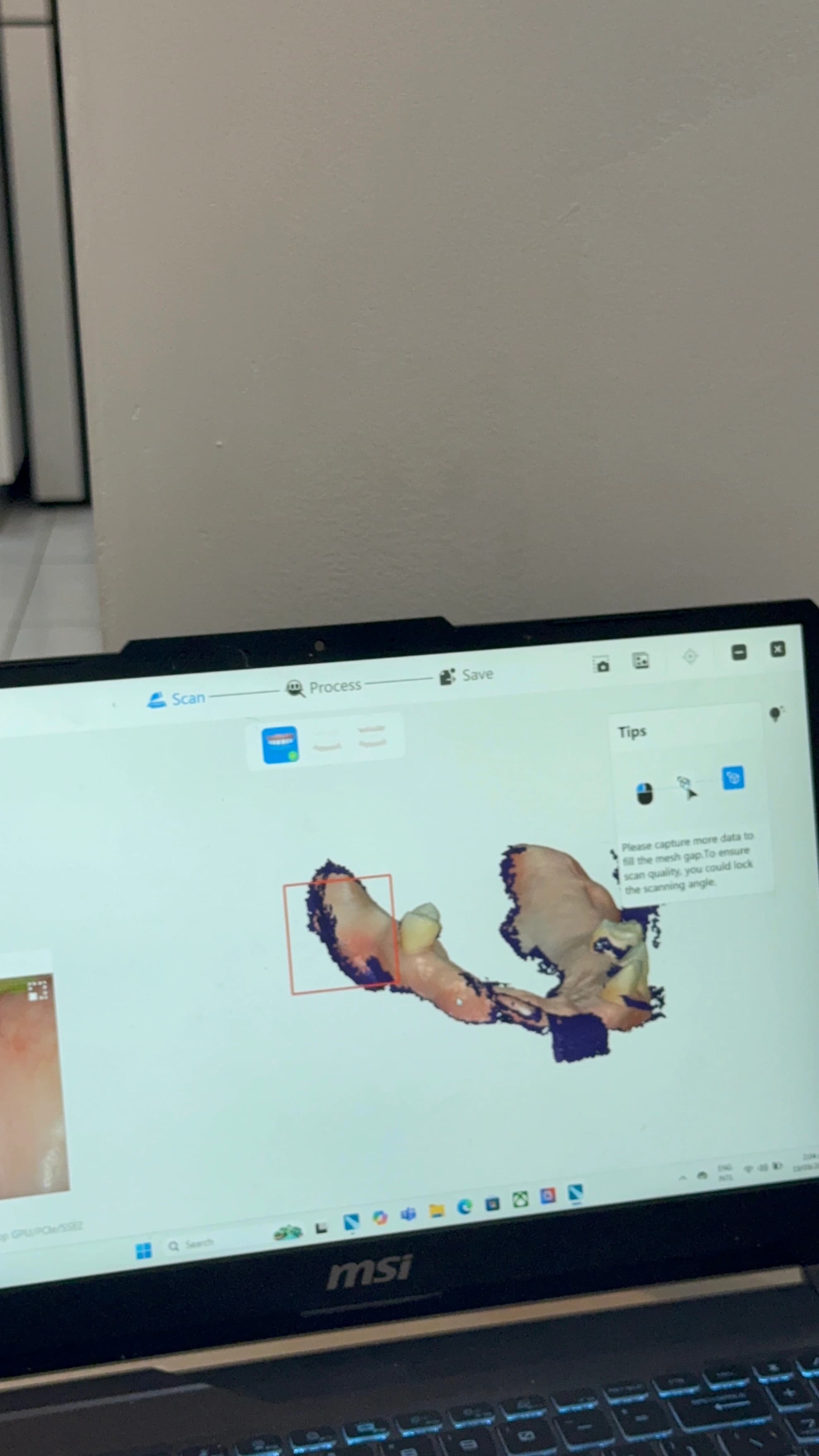 3D Intraoral Scanner thumbnail 6