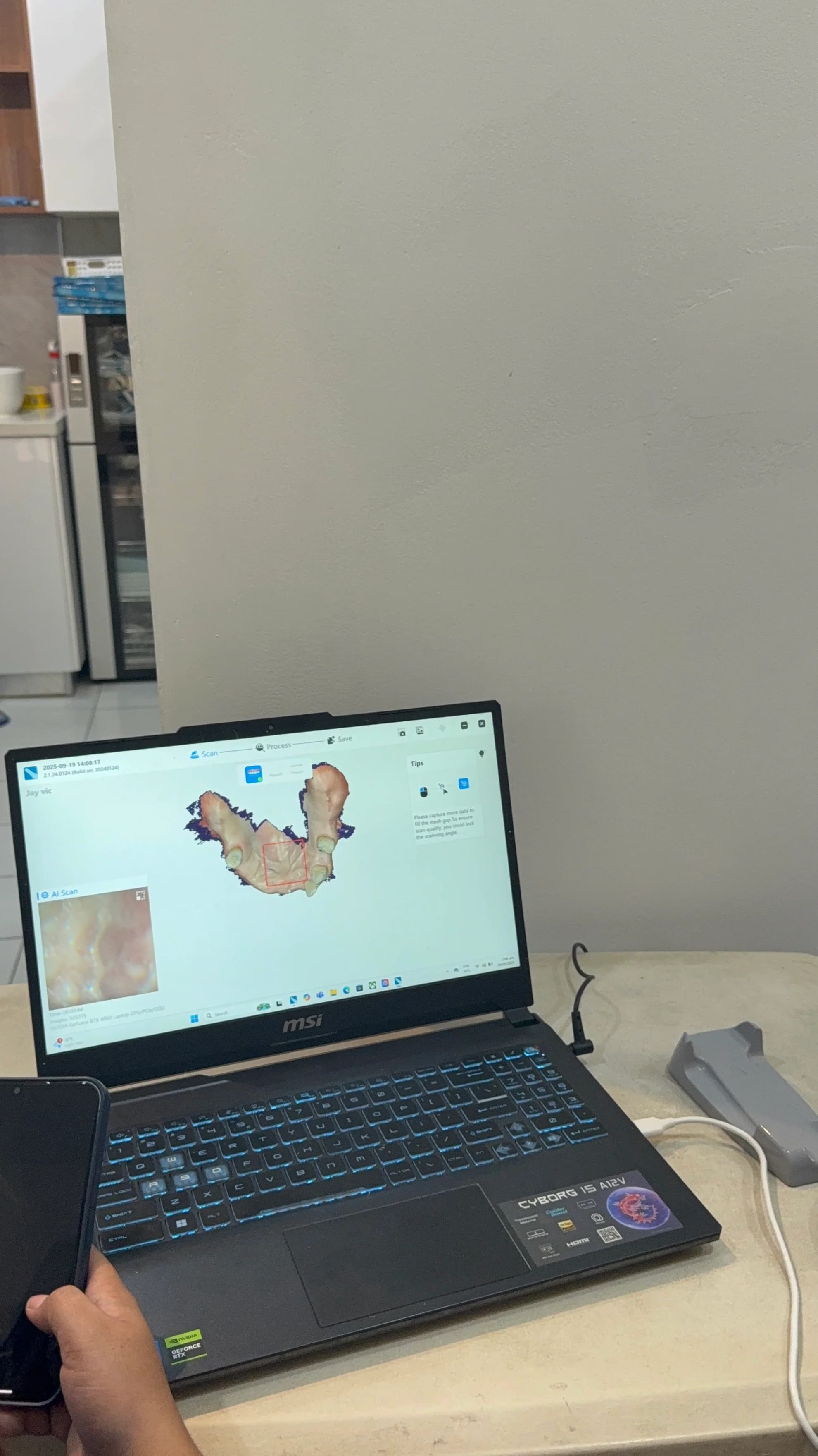 3D Intraoral Scanner thumbnail 7