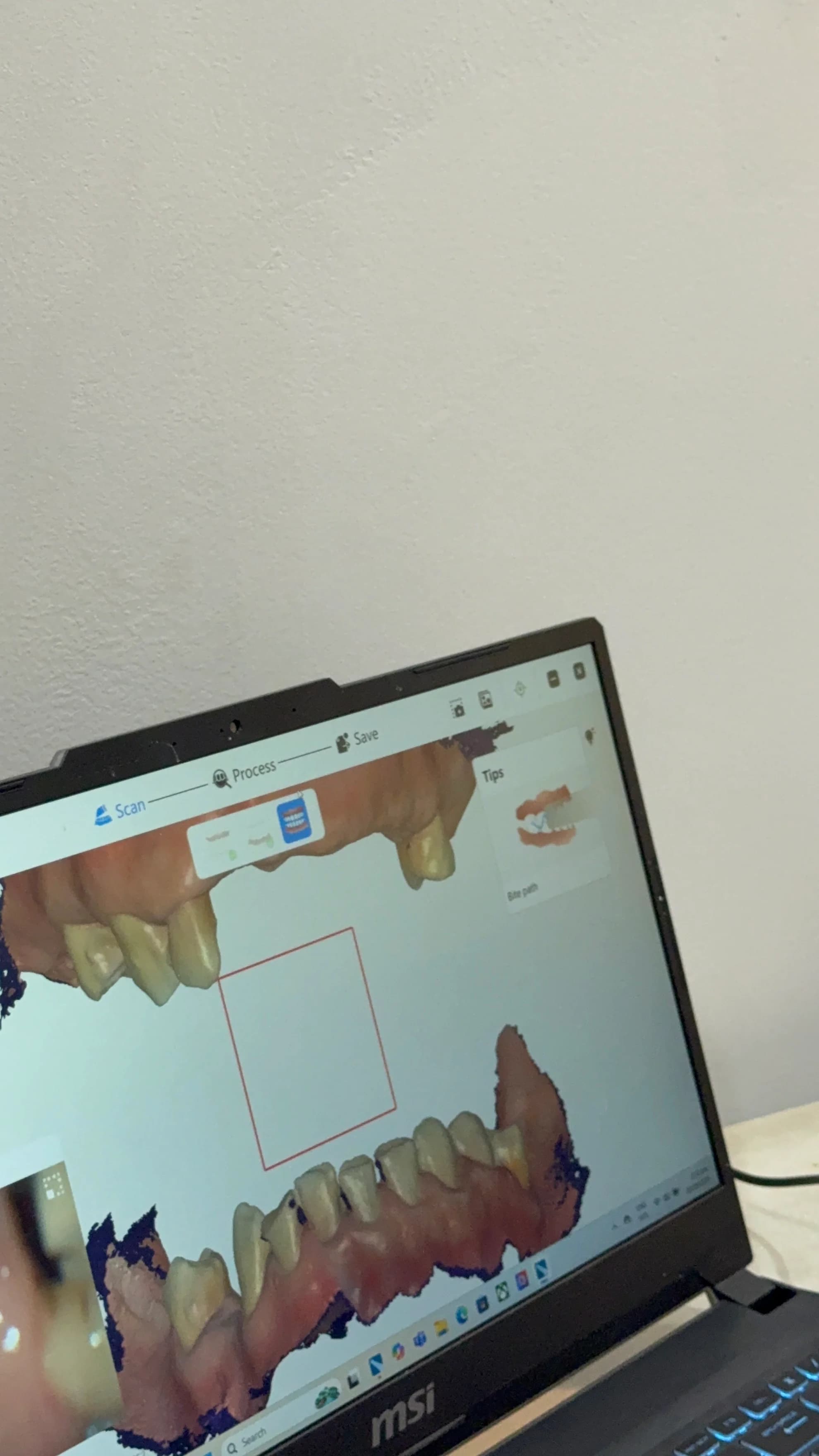 3D Intraoral Scanner thumbnail 8