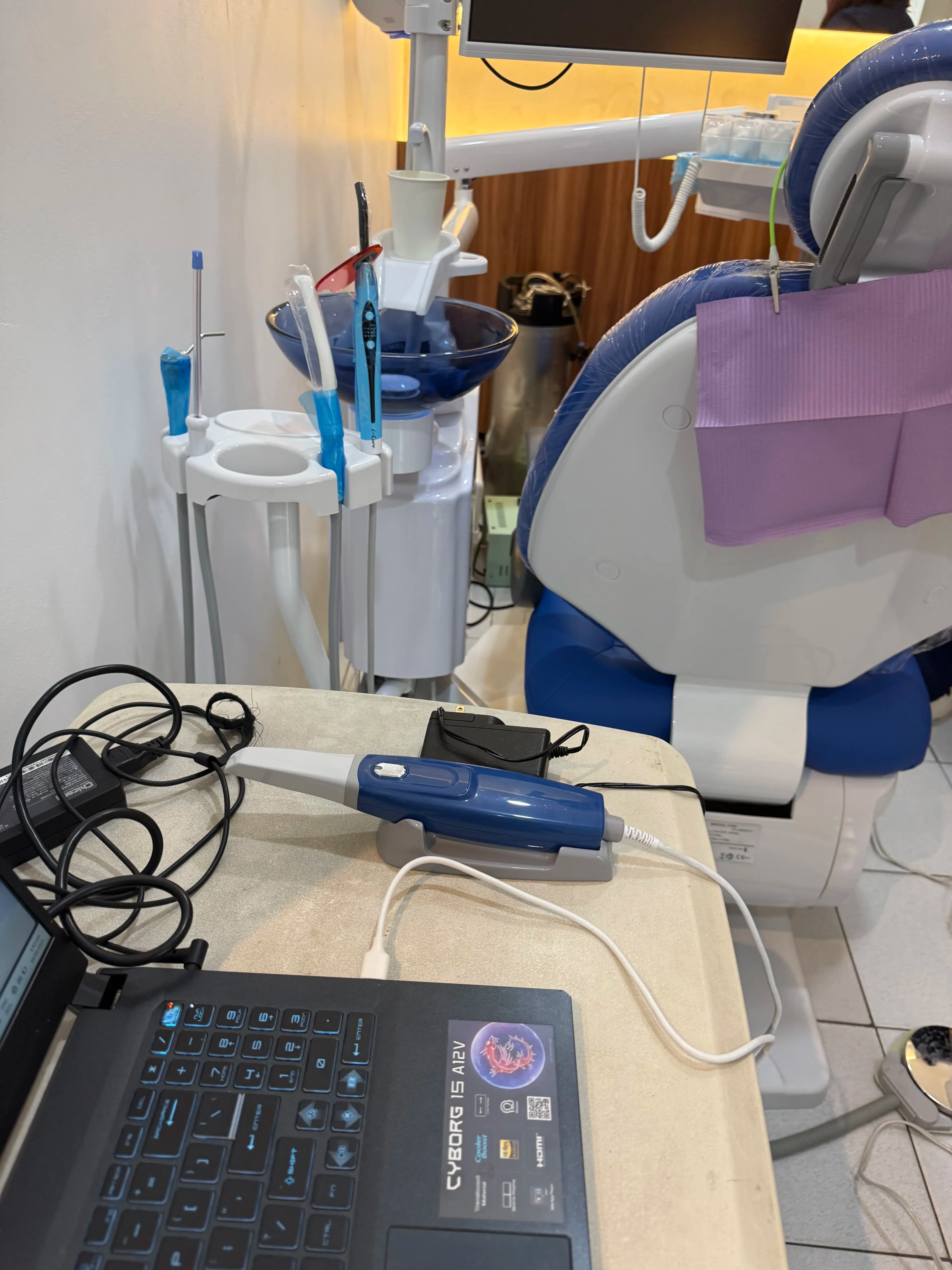 3D Intraoral Scanner - 2 of 9