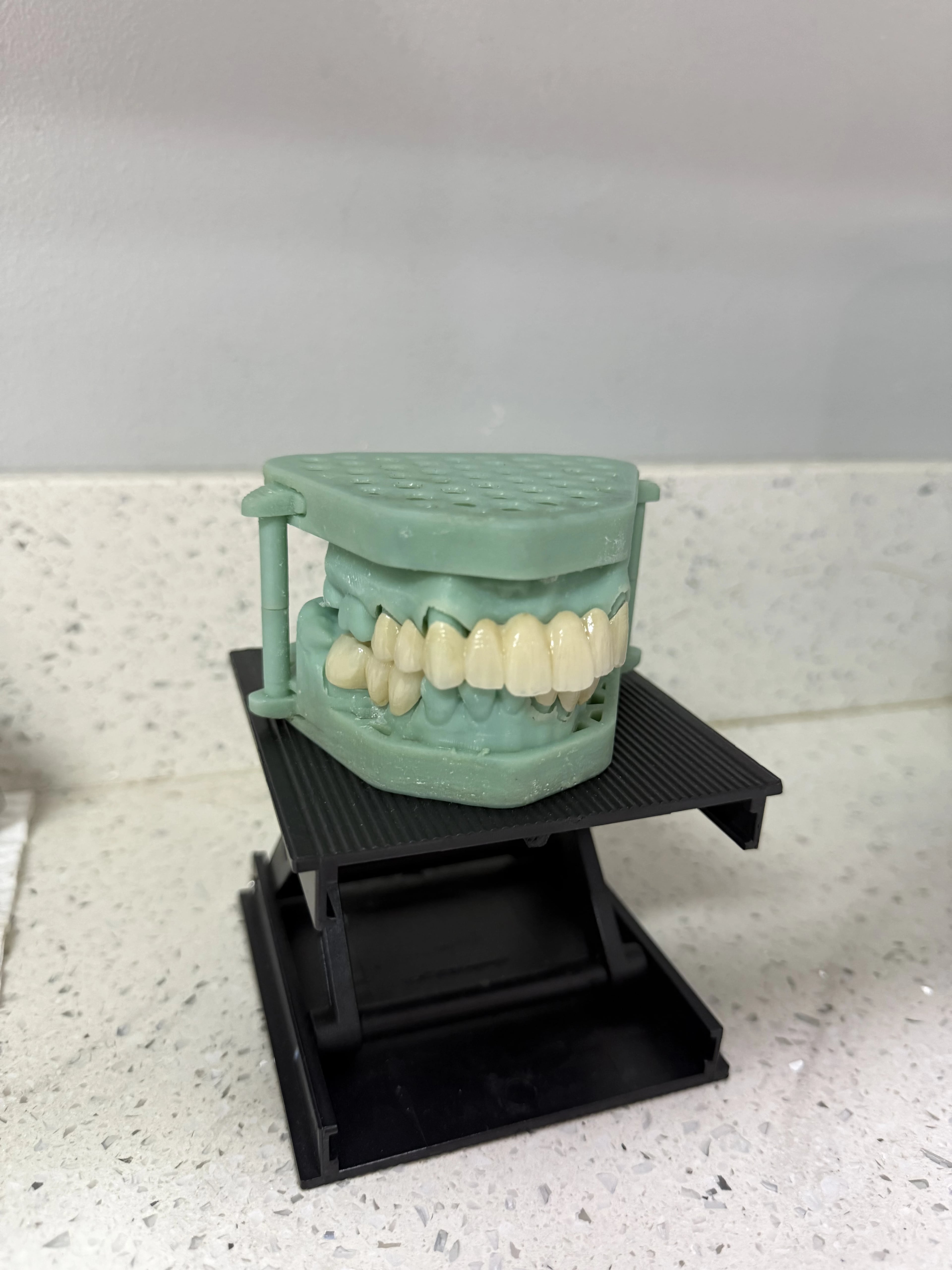 PROSTHODONTICS - Professional dental service at Legacy Smiles Cebu