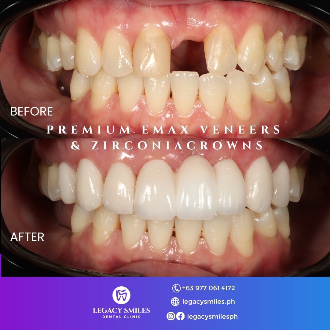 Cebu Dental Care Checklist: When to Book a Consultation